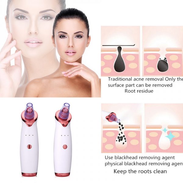 Blackhead Remover Instrument Black - Image 5