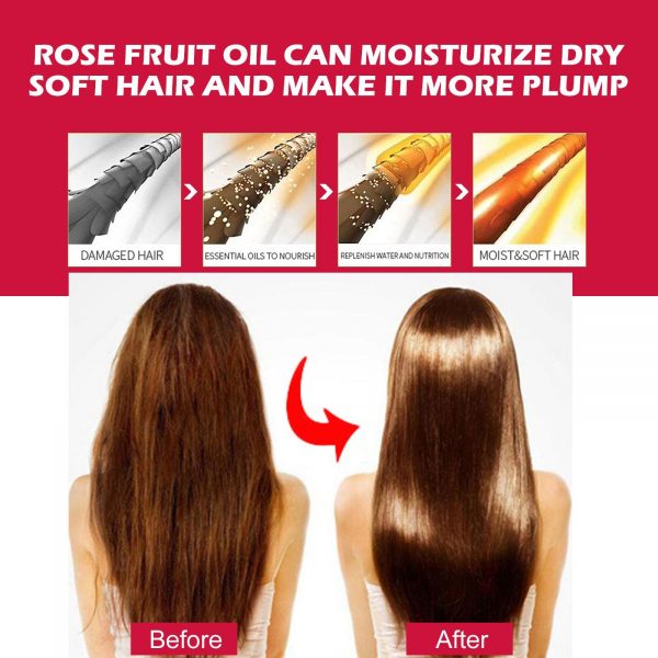 EELHOE Rosehip Facial Oil For Facial And Body Hydration - Image 4
