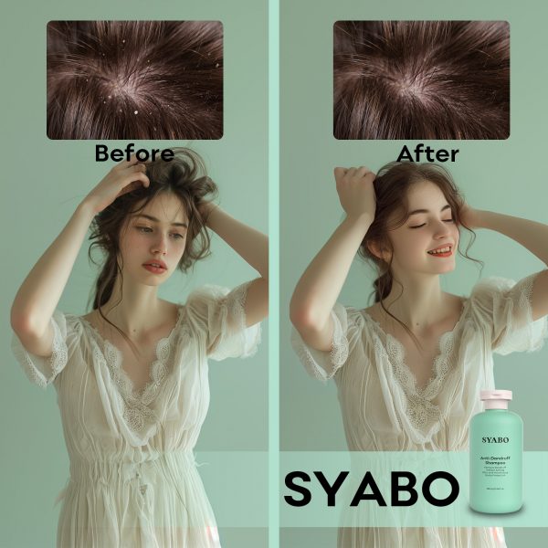 Anti Dandruff Shampoo - Image 7