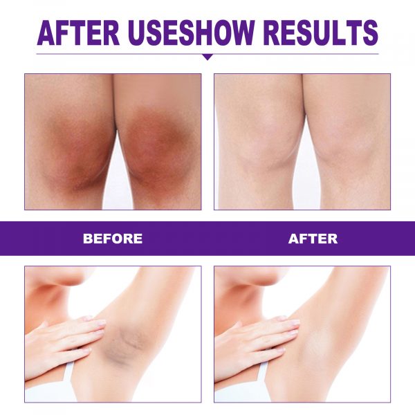EELHOE Rejuvenator Areola Intimate - Image 4