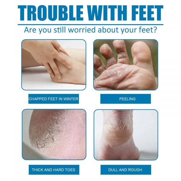 West&Montreal Exfoliating Foot Mask Foot Care Cleanses - Image 4