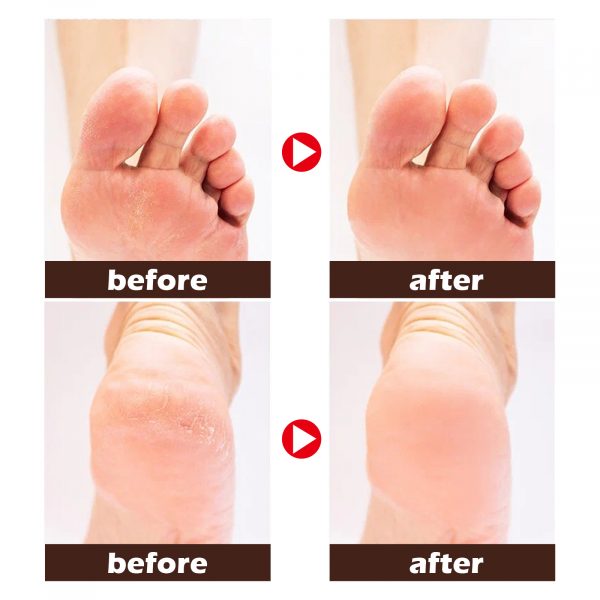 EELHOE Horse Oil Foot Cream Hydrating And Moisturizing - Image 3