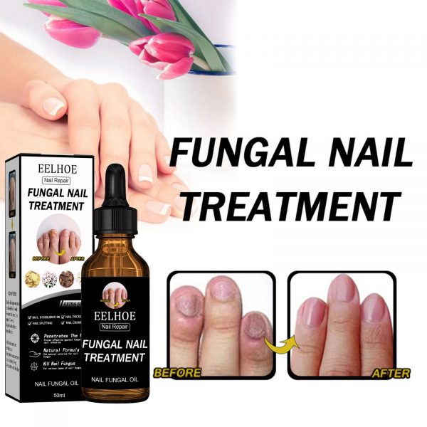 EELHOE Nail Repair Solution Thickening And Shining Nail