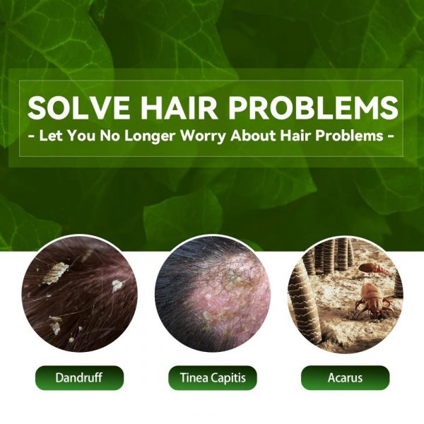 EELHOE Anti-Dandruff Shampoo - Itch Relief, Hair - Image 3