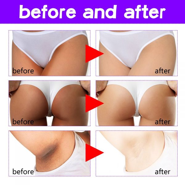 OUHOE Inner Thigh Skin Perfecting Cream Lighten - Image 4