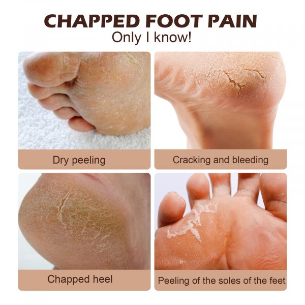 EELHOE Horse Oil Foot Cream Hydrating And Moisturizing - Image 5