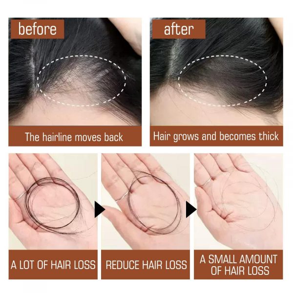 Batana Oil From Honduras - Get Fuller, Thicker, Healthier Hair - Image 2