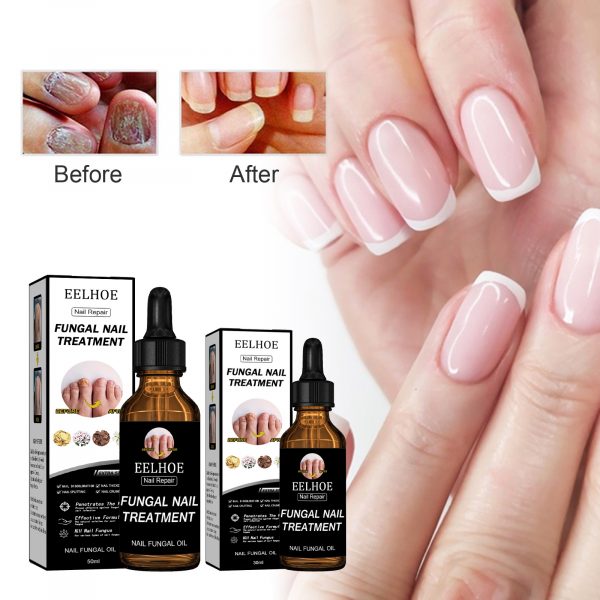 EELHOE Nail Repair Liquid Thickening, Brightening - Image 2