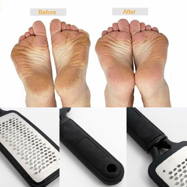 Professional Foot Callus Remover File Rasp Scraper Cracked - Image 7