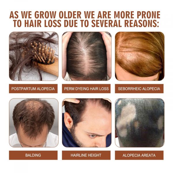 Batana Oil From Honduras - Get Fuller, Thicker, Healthier Hair - Image 9