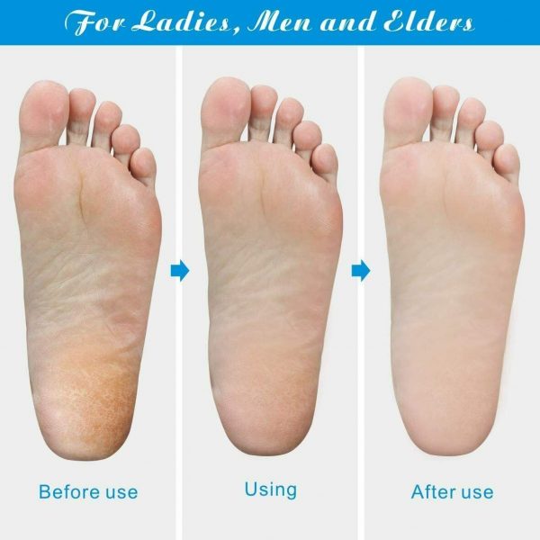 Professional Foot Callus Remover File Rasp Scraper Cracked - Image 10