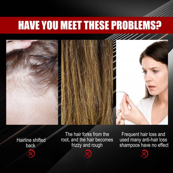 EELHOE Black Rice Hair Spray Strengthening - Image 2