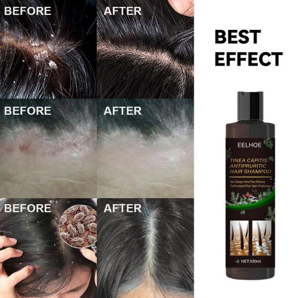 EELHOE Anti-Dandruff Shampoo - Itch Relief, Hair - Image 4