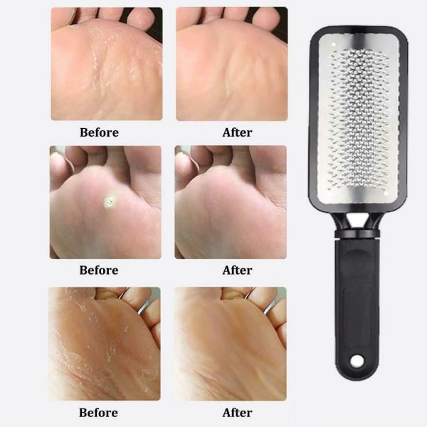 Professional Foot Callus Remover File Rasp Scraper Cracked - Image 6