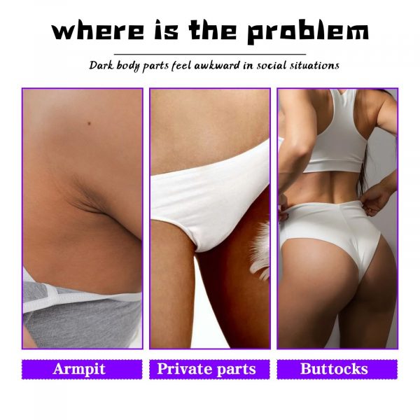 OUHOE Inner Thigh Skin Perfecting Cream Lighten - Image 6