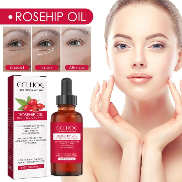 EELHOE Rosehip Facial Oil For Facial And Body Hydration