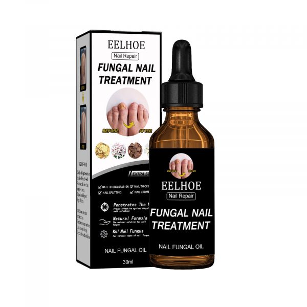 EELHOE Nail Repair Solution Thickening And Shining Nail - Image 2