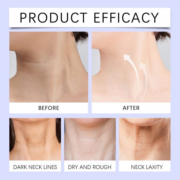 OUHOE Anti-Aging Neck Cream Anti-Aging Neck Fade - Image 5
