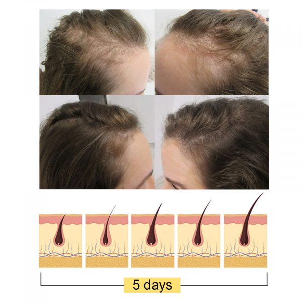 Jayswing Rice Shampoo Rice Promote Dense - Image 2